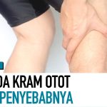 Kondisi Kram Otot Mendadak, Begini Cara Mengatasinya!