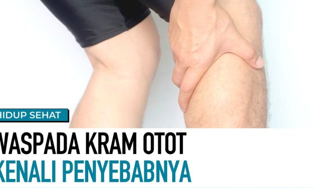 Kondisi Kram Otot Mendadak, Begini Cara Mengatasinya!